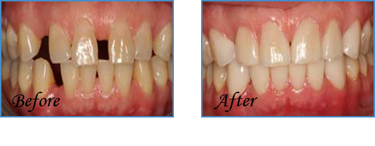 After treatment