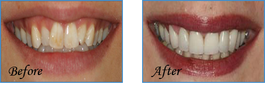 After treatment